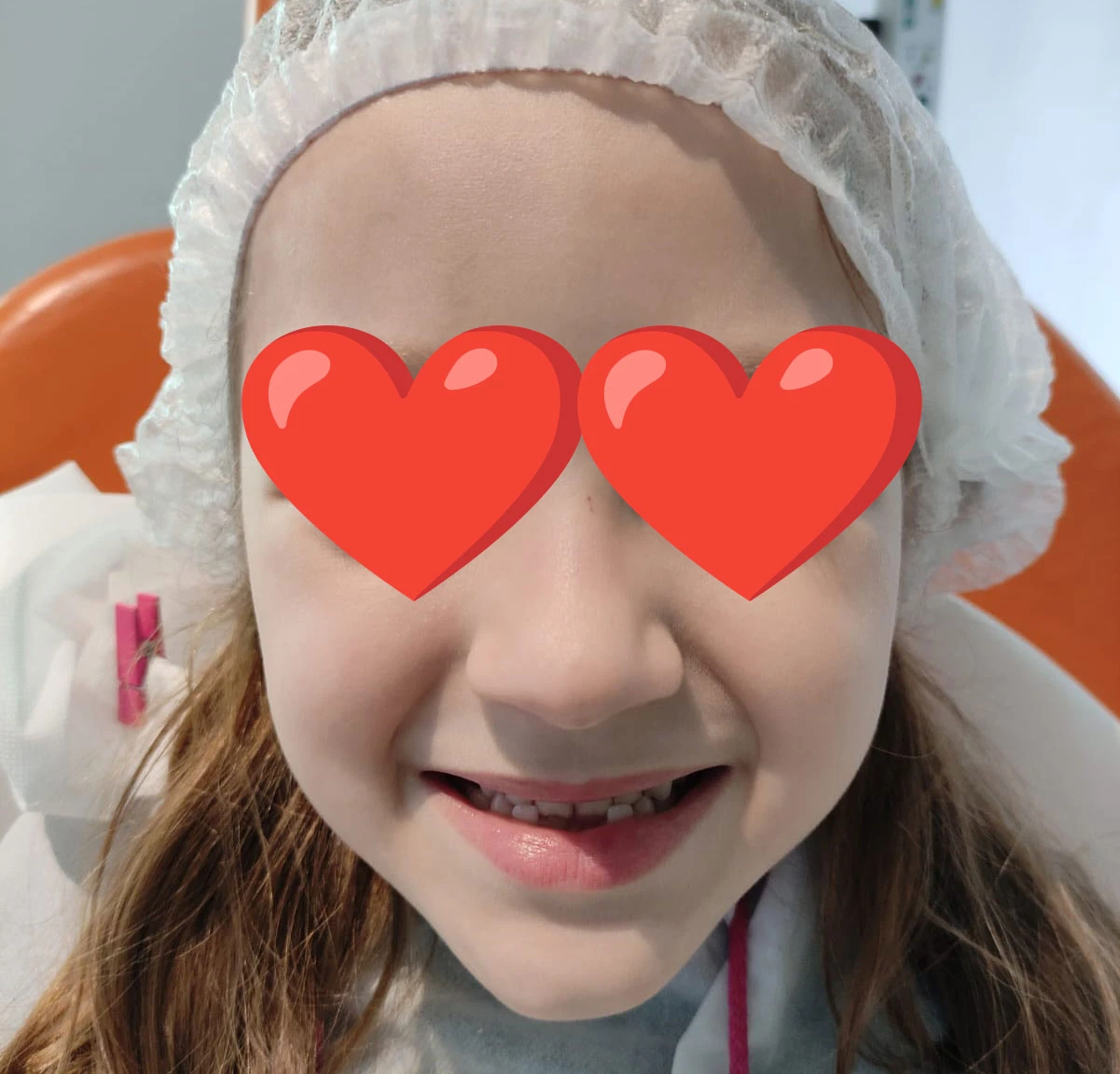 Sonrisa de frente antes del tratamiento de ortopedia